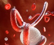 Smartphone microscope for parasitic worms