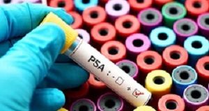 New prostate cancer test is highly-accurate and avoids biopsies PSA