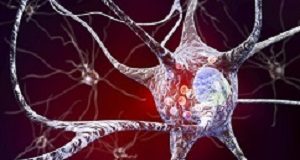 Big data, lab science suggests drug may slow Parkinson's progression in people Parkinsons