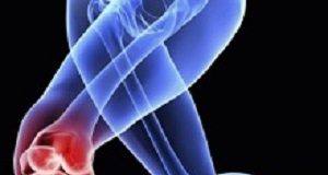 Running actually lowers inflammation in knee joints Knee