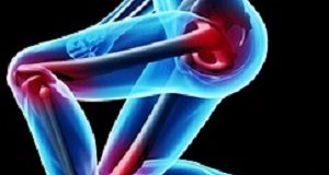 Lifetime risk of revision surgery following joint replacement JointFocus