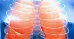 Statins alongside chemo do not benefit patients with lung cancer – UK study LungCancerFocus