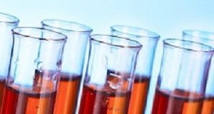 Blood test helps determine medication to treat depression EdPickBlood