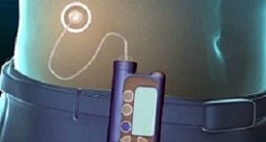 Insulin pumps no more effective than injections for type 1 diabetes FocusInsulin