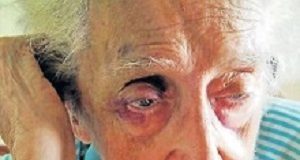 Hope Shepherd’s abusive caregiver given eight-year jail sentence MedicoLegalHopeShepherd