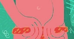 Cystitis mostly caused by bacterial infection, even when tests are negative MustReadCystitis