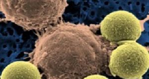 FDA panel recommends approval for gene-altering leukaemia treatment CancerTreatment