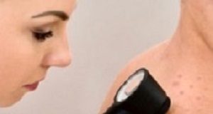 Concerns raised over accuracy of melanoma diagnoses Melanoma