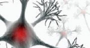 EU-blocked drug found to improve quality of life in MS MultipleSclerosis