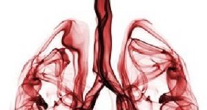 Cardiovascular Tx link to 50% reduction in lung cancer mortality risk LungCancer