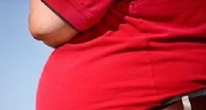 Sugar tax is not the only solution to SA's obesity crisis Obesity