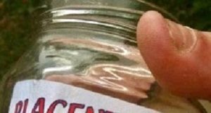 Eating placenta a potentially harmful fad that 'should be discouraged' Placenta