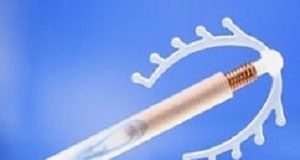 IUDs may cut cervical cancer risk by a third — US systematic review IUDCancer