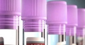 The state of the global HIV and TB response as we move to the end of 2017 HIVMeds