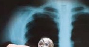 GPs fail to spot two out of every three cases of pneumonia Pneumonia