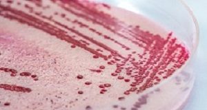 WHO sends expertise as SA listeriosis deaths keep rising Listeria