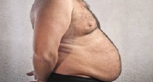 'Obesity paradox' is a significant factor in metastatic melanoma survival Oncology