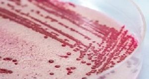 Listeria outbreak prompts improvements in SA food safety standards Listeria