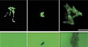 Innovative 'invisible ink' successfully detects TB TBbacteria