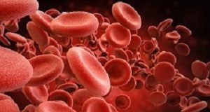 Significantly higher death rates in blood type O severe trauma patients red blood cells in vein