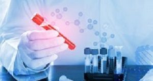 Single blood test accurately diagnoses diabetes Bloodtest