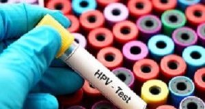 HPV test better than Pap smear at detecting precancerous changes HPVtest