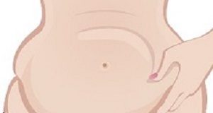 Belly fat associated with reduced cognitive function Bellyfat