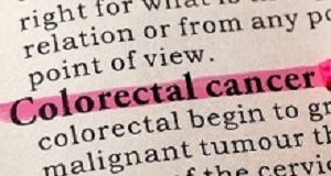 Improving survival rates for patients with colorectal cancer Colorectal