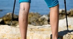 Adequate compression therapy cuts complication risk in DVT thrombosis