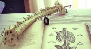 Chiropractic neck manipulation and vision loss Chiropractice