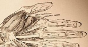 Steroid injection or wrist splint for first-time carpal tunnel syndrome? Hand