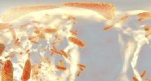 It's not just about the number of hospital beds… Klebsiella