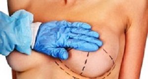 FDA's 'deceptive' system allowed implant complaints to escape notice Breast