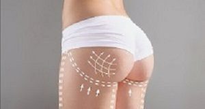 The Bottom Line – the costs and risks of the butt-lift Butt