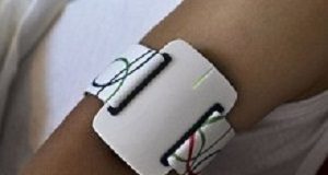 New epilepsy seizure-detecting device to cut nocturnal fatalities Nightwatch