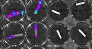 Anti-bacterial coating for intravascular catheters Intravascular