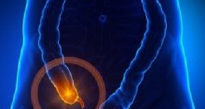 Appendix removal associated with development of Parkinson’s disease Appendix
