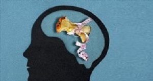 UK medical schools fail to provide adequate training on eating disorders Eating