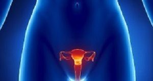 Invasive cervical cancer rates high in women living with HIV in Africa and Latin America uterus