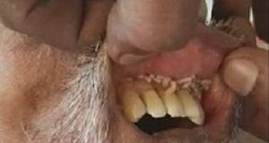 Health MEC 'quite shocked' over maggots in mouth of patient who died Maggots