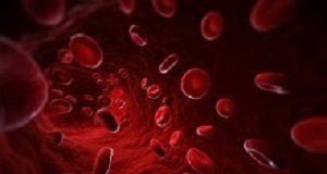 Simple blood test identifies concussions absent on CT scans Blood