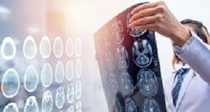 Widely available drug reduces head injury deaths by up to 20% — large trial Brain