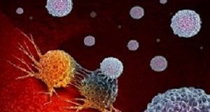 Immunotherapy substantially improves survival in advanced melanoma patients Cancer