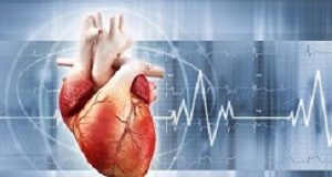 Robust study finds stents no better than drugs for many, challenging current practice Heart