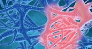 Curb chronic inflammation to reduce risk of chronic disease mortality Inflammation