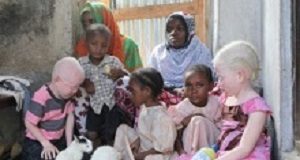 Malawian albinos are being kidnapped and sacrificed Albino