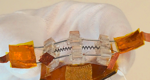 New bladder voiding device with real-time volume detection Bladder