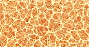 Nitrates don't affect bone health in post-menopausal women — randomised controlled trial Bone