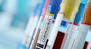 Experts urge: Stop random COVID-19 testing and sort out the backlog Test