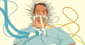 Reducing psychological trauma in ARDS patients on mechanical ventilation Ventilator